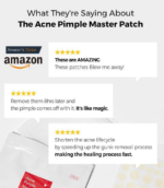 cosrx acne pimple master patch